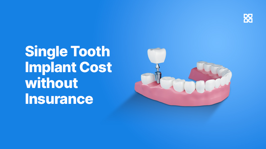Single Tooth Implant Cost without Insurance