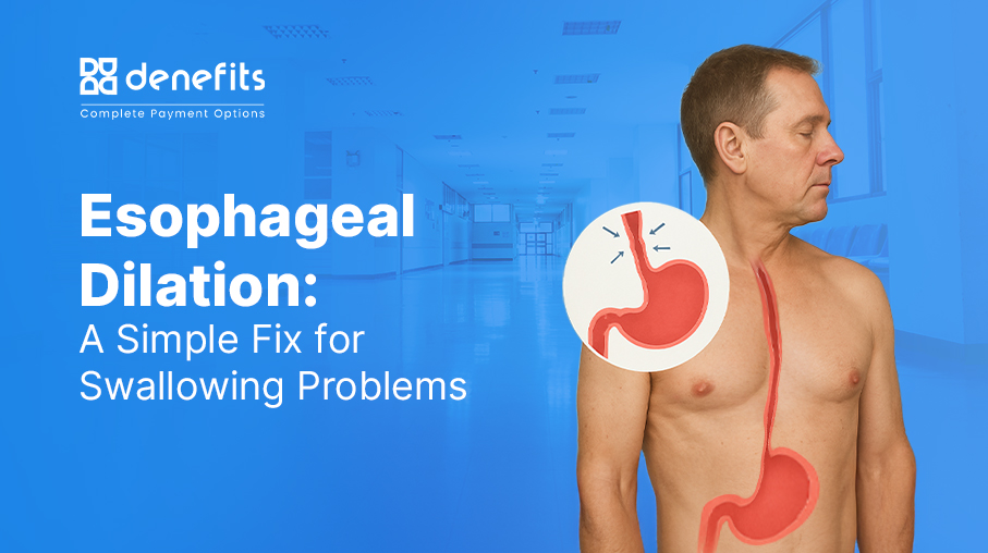 Esophageal-Dilation